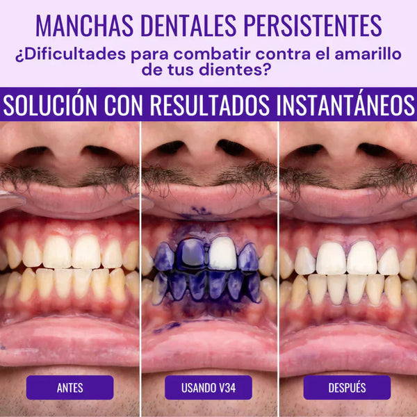 HISMILE CREMA DENTAL BLANQUEADORA