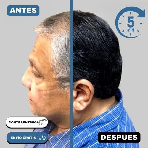 Shampoo (Removedor de Canas) - Tratamiento para 10 meses